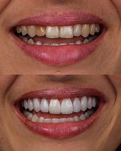 Antes-e-depois1.webp